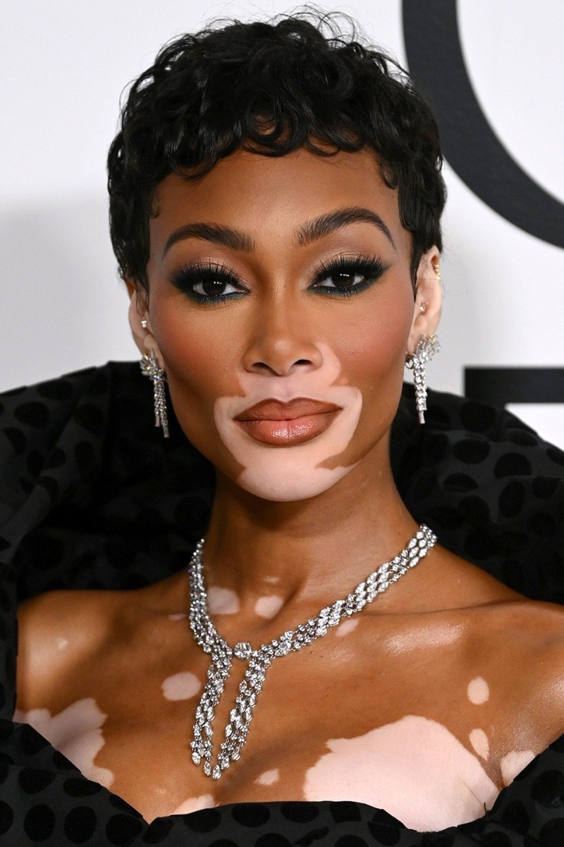 Winnie Harlow